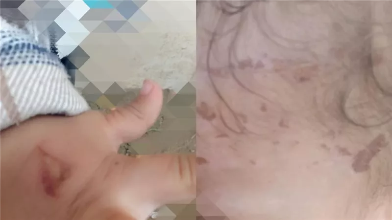 أب يتهم طليقته بتسببها فى إصابات وجروح لصغيره قائلة: 