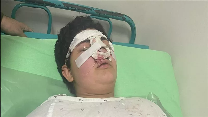 خاص .. إصابة طالب بكسر في الأنف بعد واقعة تنمر داخل مدرسة خاصة ببني سويف