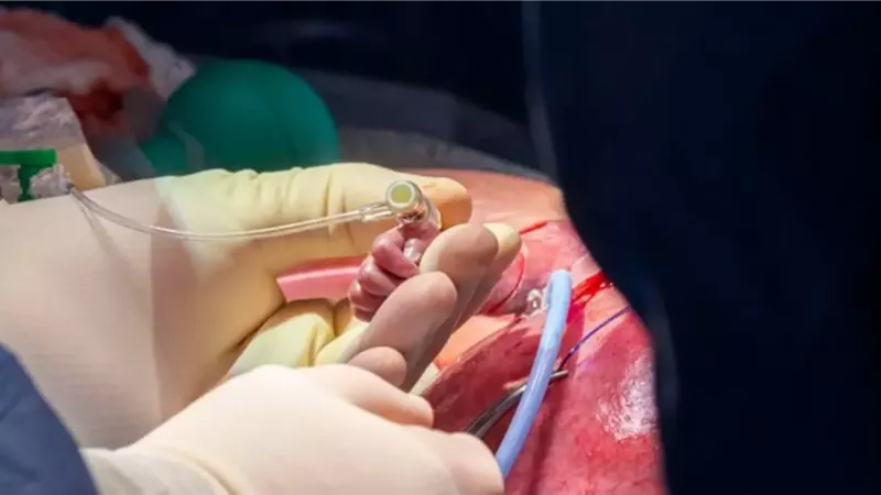 لأول مرة.. جراحات للأجنة داخل الرحم في وزارة الصحة.. وهاني إمبابي يكشف