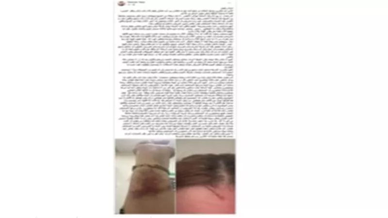 بسبب مخالفة الزيارة.. تفاصيل مشاجرة بين 3 سيدات وممرضتين بمستشفى في بورسعيد 