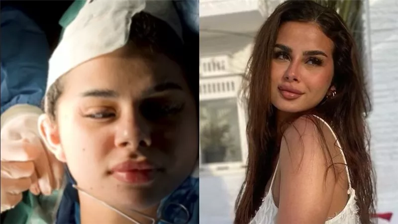 منة عرفة تخضع لعميلة تجميل في مكان غريب |صور                                  