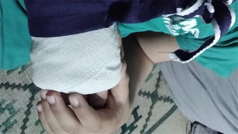 طفل يبكي ساعتين لكسر ذراعه داخل المدرسة دون إسعاف.. وشكوى تثير الجدل