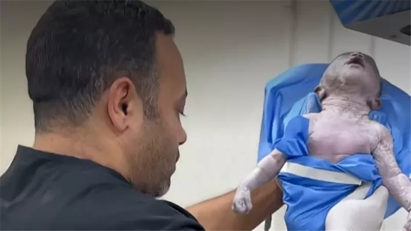 «وُلد شبه ميت».. طبيب مصري ينقذ حياة مولود في اللحظات الأخيرة |فيديو