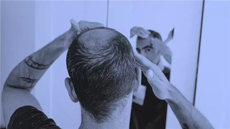 دواء فموي جديد يحقق نتائج واعدة لنمو الشعر في 6 أشهر