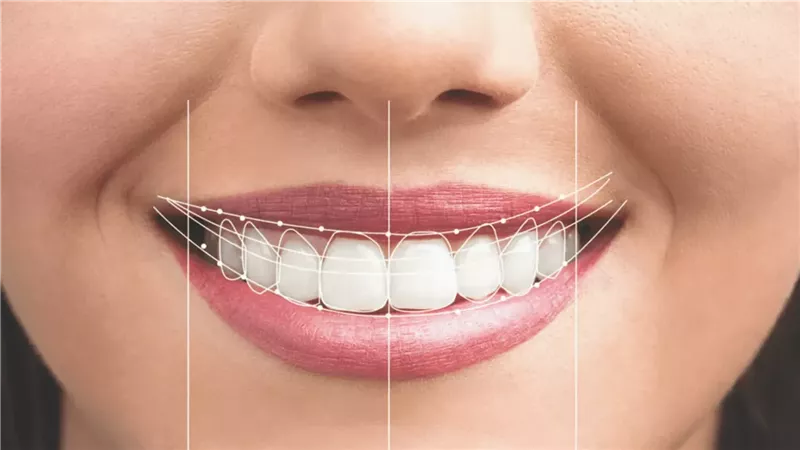 ضحكتك تقولك كل حاجة.. اعرف صحة أسنانك من ابتسامتك بس