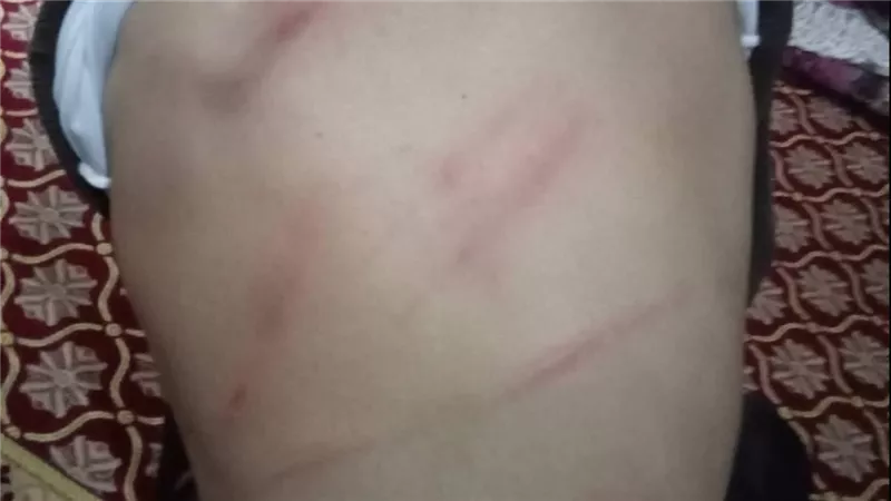     واقعة ضرب طالب تشعل الغضب.. مطالب بالتحقيق في مدرسة بالشرقية 