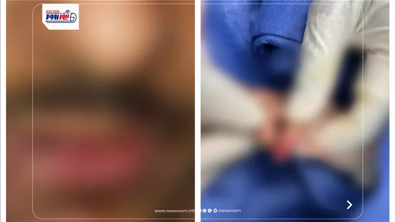 طوارئ مستشفى العدوة تنجح في إنقاذ طفل من البتر وإعادة ملامح وجه مريض بالمنيا