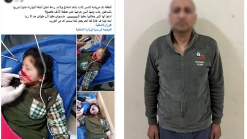خلاف على محصول ينتهي بإصابة طفلة بآلة حادة في دمياط.. والأمن يضبط المتهم