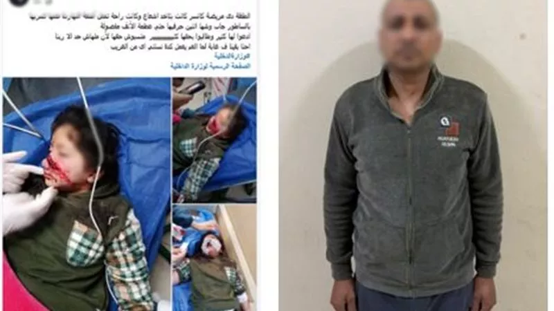 خلاف على أرض زراعية ينتهي بإصابة طفلة.. التحقيق مع عامل تعدى على ابنة شقيقه 