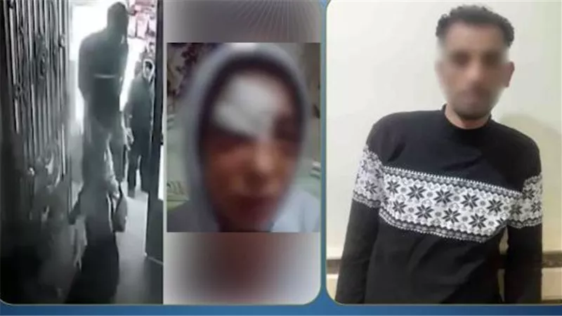 «بسبب رفضها العودة له».. ضبط عامل تعدى بالضرب المبرح على عاملة بالدقهلية