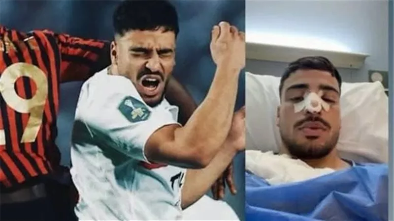 تأكيدًا لنيوز رووم.. جراحة الأنف تبعد محمد إسماعيل وتفسر غضبه بعد النهائي