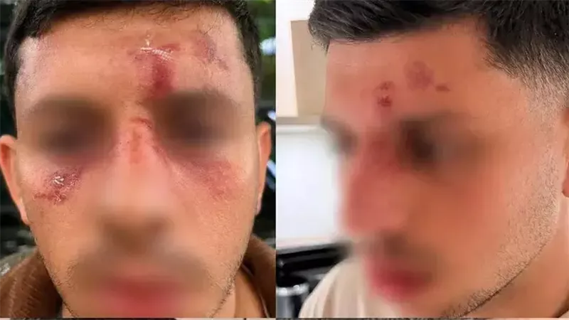 ظننت أنني سأموت.. تعرض إسرائيلي للضرب في لندن بعد تحدثه بالعبرية