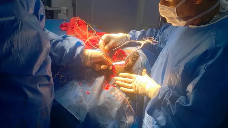 صحة الشرقية: إجراء أول جراحتين للمخ والأعصاب لانقاذ حالات حرجة فى حادث