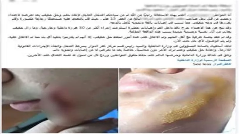 بسبب لهو الأطفال.. ضبط طالب لاعتدائه على زميله بقطعة زجاج في البحيرة