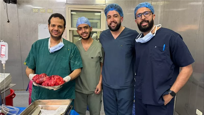 فريق جراحة قصر العيني ينجح في استئصال ورم نادرمن صدر مريض ستيني