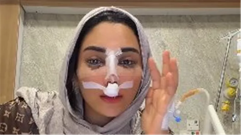 البلوجر أم خالد تعلن خضوعها لعملية تجميل في الأنف وتنشر فيديو بعد العملية