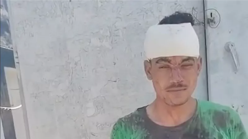 الأمن يفحص واقعة إصابة شخص بـ38 غرزة في الرأس إثر مشاجرة عائلية بالدقهلية