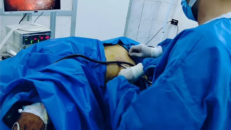 الشرقية تعلن نجاح أول جراحة متقدمة لاستئصال الكلية اليسرى والمرارة بالمنظار