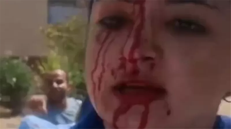 حبس متهم بالتعدي على طليقته ووالدتها وشقيقتها بشبين القناطر بالقليوبية