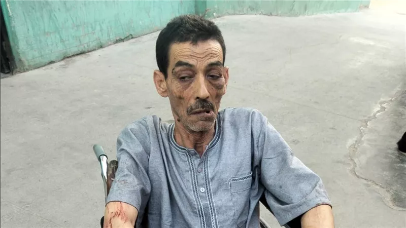 اعتداء على مسن في حلوان.. وضبط متهم وجاري ملاحقة آخرين على خلفية خلافات عائلية
