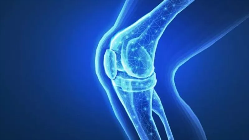 دراسة ألمانية: علاج غير جراحي قد يخفف آلام التهاب مفصل الركبة