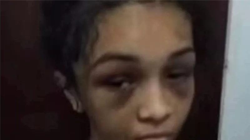 واقعة تعذيب لطفلتين تثير غضبًا واسعًا وتعيد الجدل حول ملف الحضانة 