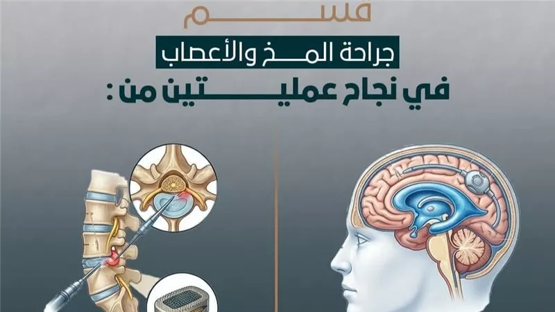 عمليتان دقيقتان تنهيان معاناة مريضين داخل مستشفى طيبة التخصصي بالأقصر 