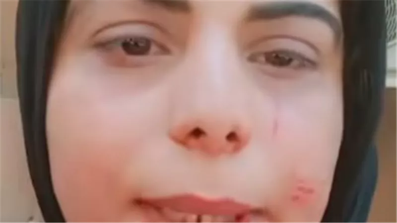 «مباحث بنها» تكشف الحقيقة.. نهاية أزمة المريضة والممرضة بمستشفى جامعة بنها 