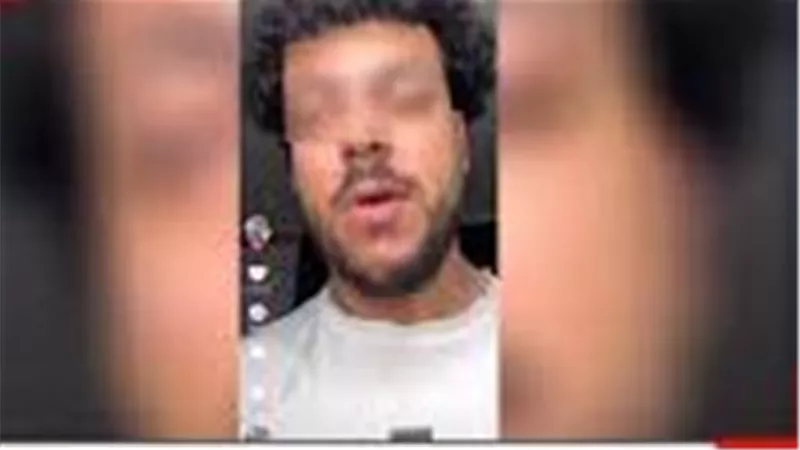 بعد 7 عمليات جراحية.. ضحية حريق مصنع بالشرقية يكشف تفاصيل معاناته