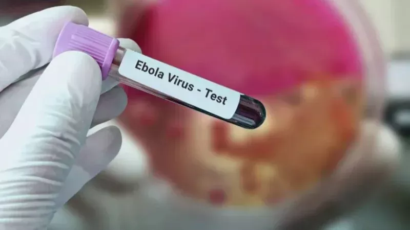الأمم المتحدة تحذر: تفشي إيبولا قد يكبد أفريقيا خسائر تصل إلى 3.6 مليار دولار