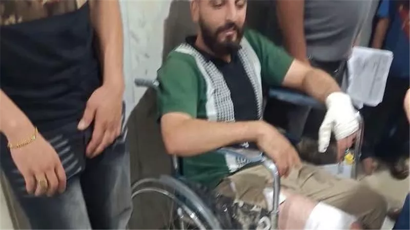 ارتفاع مصابي عقر كلب بالمنوفية لـ 12 حالة والأهالي تطالب المسئولين بالتدخل