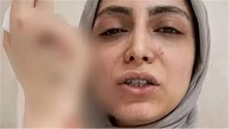 طبيبة الأسنان المعتدى عليها: المريضة واختها سحلوني على الأرض وضربوني بالرجل