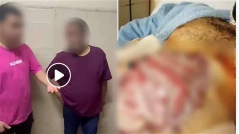 صورة لجرح المتوفى.. الداخلية تكشف حقيقة وفاة متهم داخل حجز بالجيزة