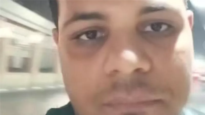 سائق يروي تفاصيل خسارة أجر رحلة للمطار بعد موقف مفاجئ في كمين 