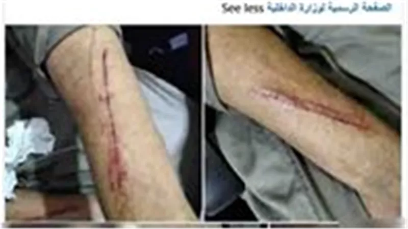خلافات الميراث تقود للاعتداء على شقيق وأسرته.. وضبط المتهمين في الشرقية