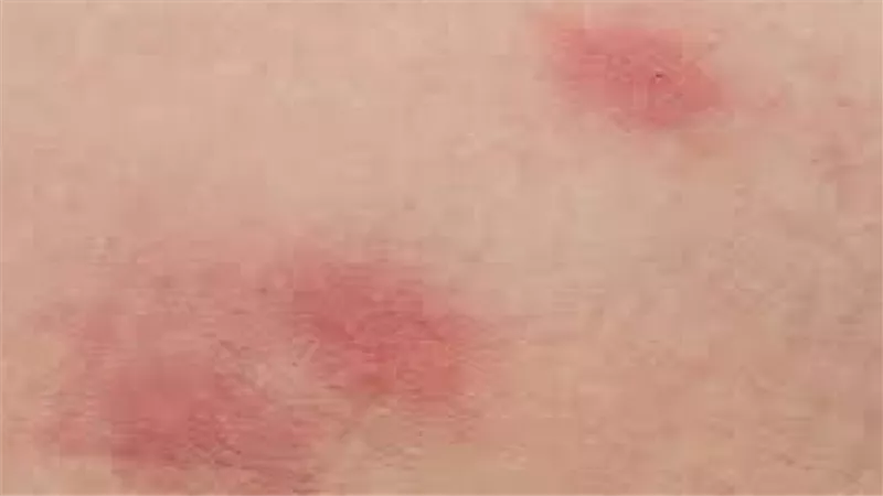 لا تتجاهليها.. طرق تمكنك من الوقاية من الحساسية لدى الأطفال