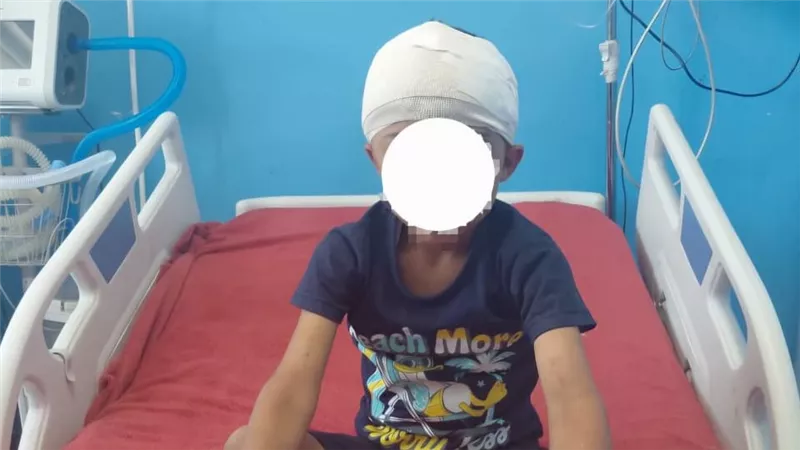 فريق طبي بجامعة سوهاج ينجح في استخراج رصاصة من مخ طفل وإنقاذه دون مضاعفات