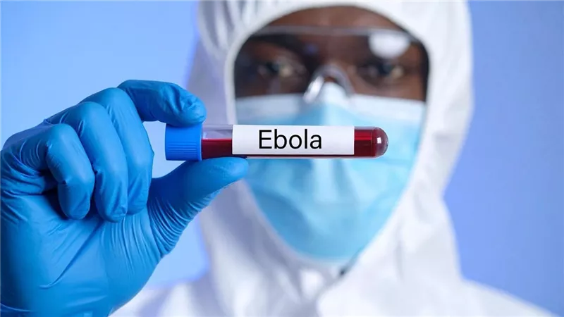 إيبولا في الكونغو يسير نحو أسوأ تفش للفيروس في التاريخ