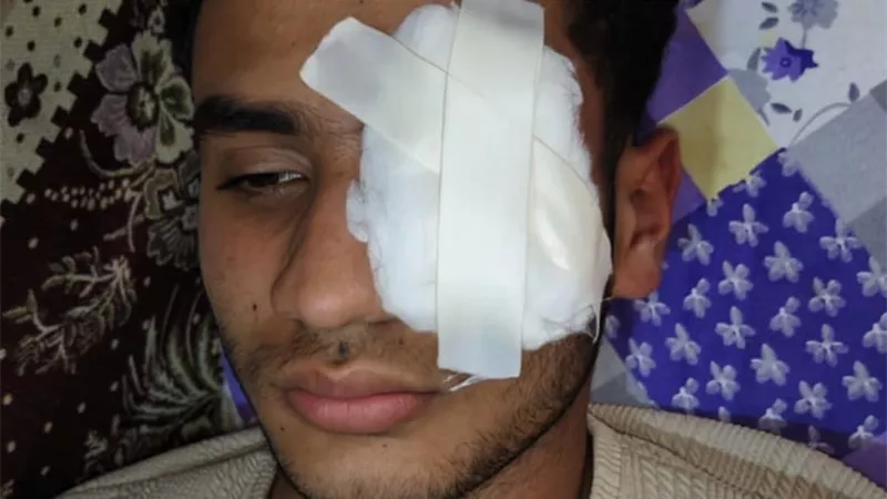 شاب يفقد عينه في مشاجرة داخل سيارة نقل عمالة بطنطا