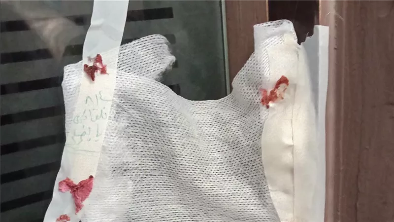 تشميع مركز تجميل ببورسعيد بعد ضبط صيدلانية تمارس الطب دون ترخيص