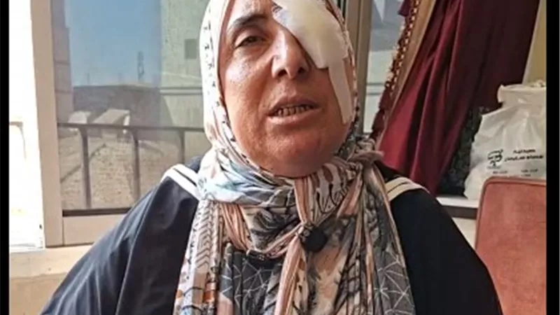 سماح تفقد عينها بسبب خلاف على الميراث.. اعتدى عليها أشقاؤها بعد مطالبتها بحقها