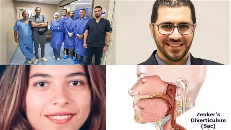 خلال نصف ساعة.. تقنية جديدة تنجح في علاج جيب المريء بمستشفيات جامعة بني سويف