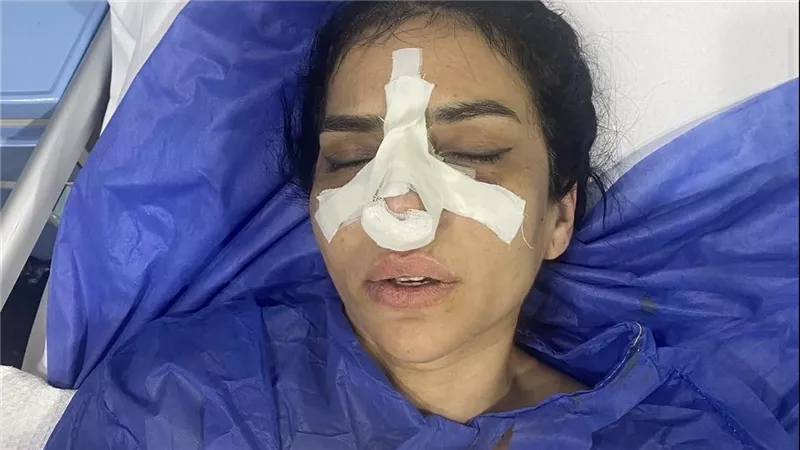 «دخلت أتمرن.. خرجت بكسر في أنفي».. ياسمين حمدي تروي لحظات الرعب داخل جلسة بيلاتس بالساحل
