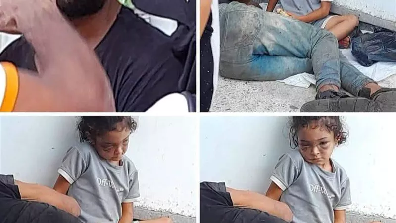 عينها وارمة وملامحها تثير الجدل.. استغاثة لإنقاذ طفلة من رجل بالإسكندرية