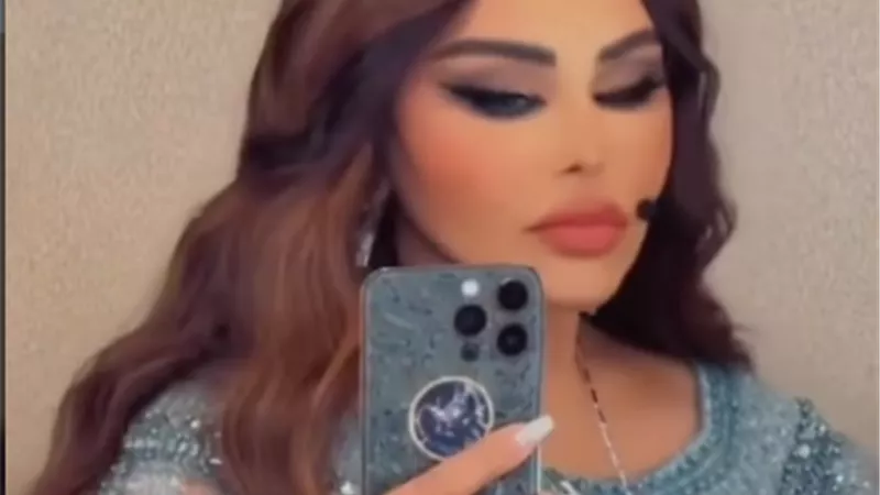 بعد عملية شد الوجه.. أحدث ظهور للمطربة أحلام الشامسي |فيديو 