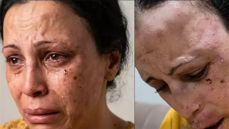 تفاصيل أبشع حفل تعذيب لفتاة «صماء» على يد شقيقها.. والسبب صادم