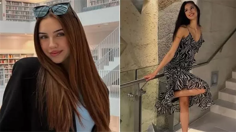 عن عمر ناهز 22 عامًا.. وفاة ملكة جمال النمسا بعد 7 جراحات للقلب