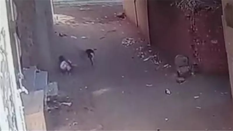 إصابة طفلة بعقر كلب فى قرية شنتا الحجر ببركة السبع 
