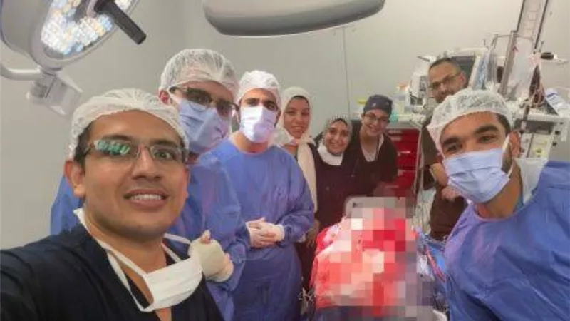 جراحة استغرقت ٤ ساعات.. أطباء قصر العيني يستخرجون مسمار من جمجمة