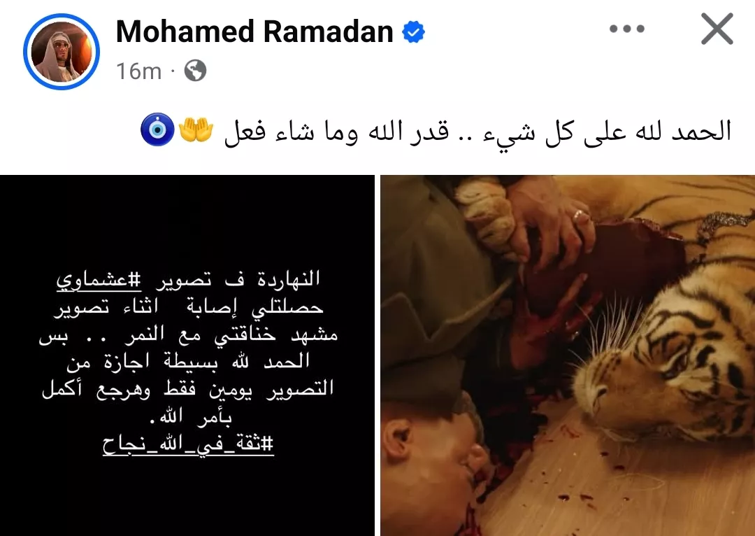 إصابة محمد رمضان في تصوير مسلسل عشماوي&nbsp;